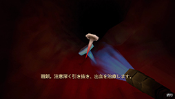 画像ギャラリー No.004のサムネイル画像 / 大腸内視鏡検査で釘や虫などを除去する“ボディホラーゲーム”「Revenge Of The Colon」12月23日発売